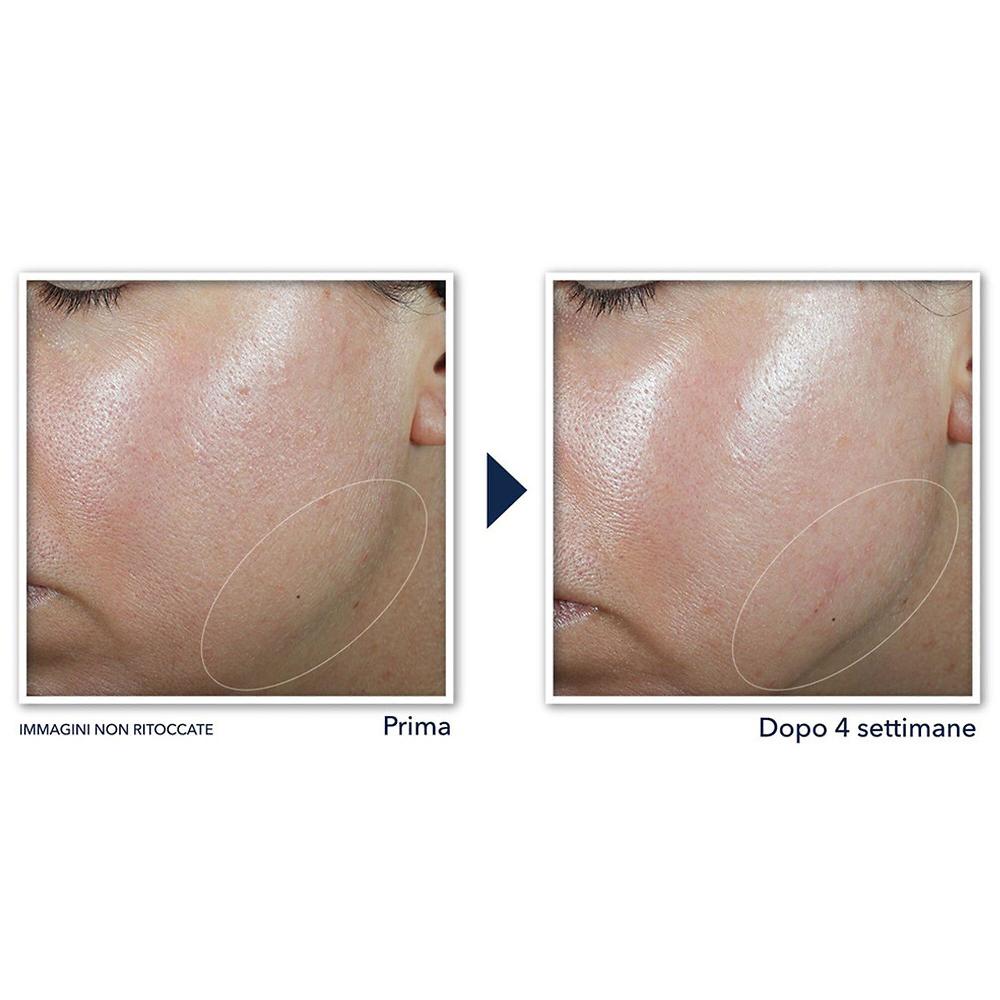QVC RoC Crema viso Derm Correxion® ridefinisce e rassoda Pezzi Unici