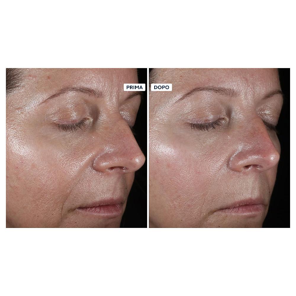 QVC Perricone MD Kit 4 prodotti viso: detergente idratante siero viso e occhi Nuovo