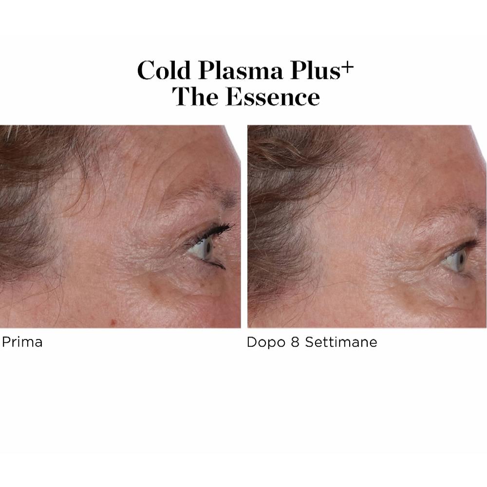 QVC Perricone MD Siero viso Cold Plasma Plus+ The Essence Offerta