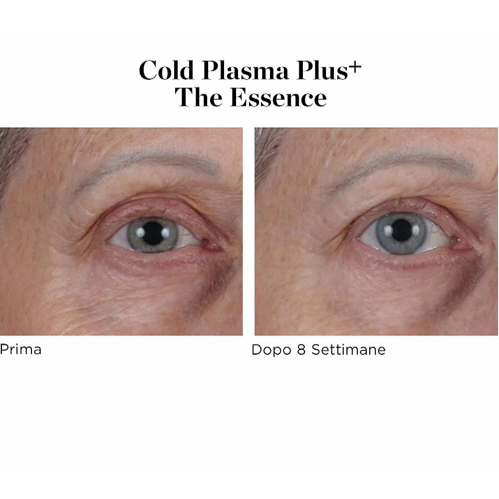 QVC Perricone MD Siero viso Cold Plasma Plus+ The Essence Offerta