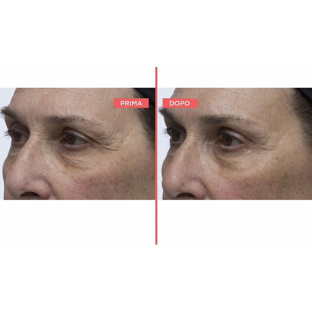 QVC Perricone MD Siero occhi Essential FX e mascara No Makeup Fino al 55% di sconto