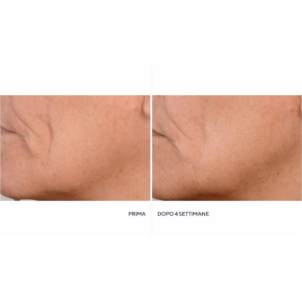 QVC Perricone MD Crema notte Essential FX + siero Firming&Lifting Convenienza