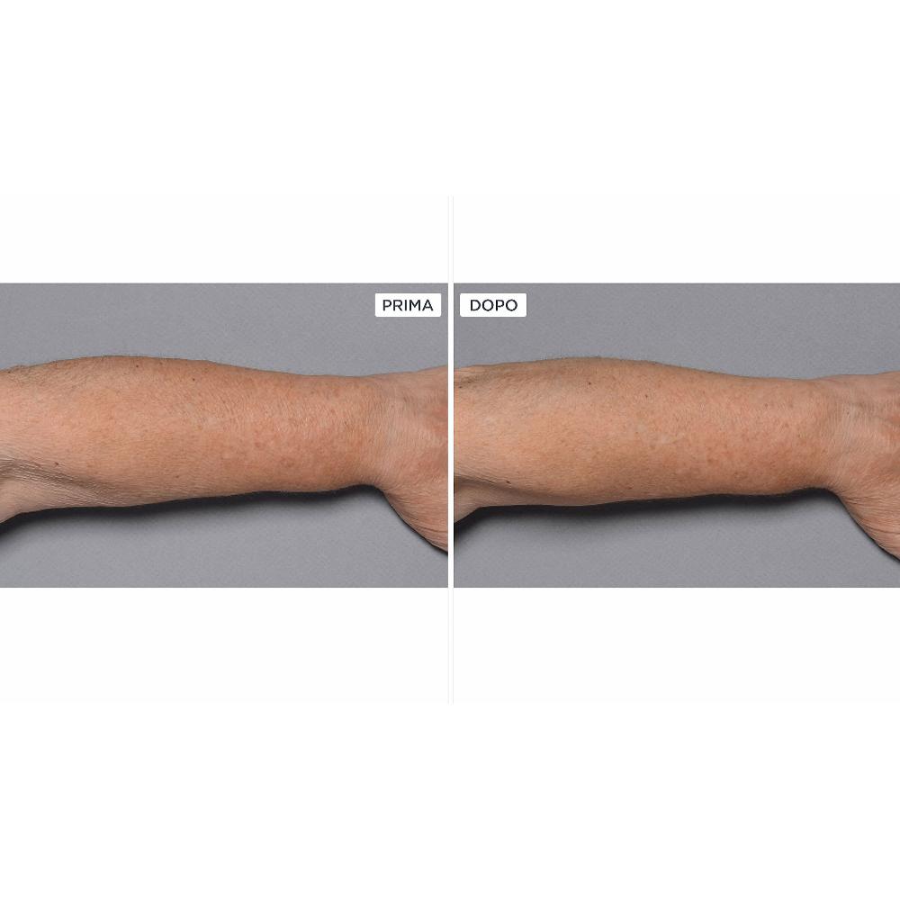 QVC Perricone MD Cold Plasma+Fragile Skin corpo 2pz Negozi Online
