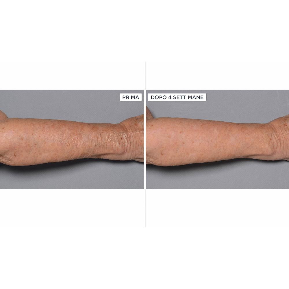 QVC Perricone MD Cold Plasma+Fragile Skin corpo 2pz Negozi Online