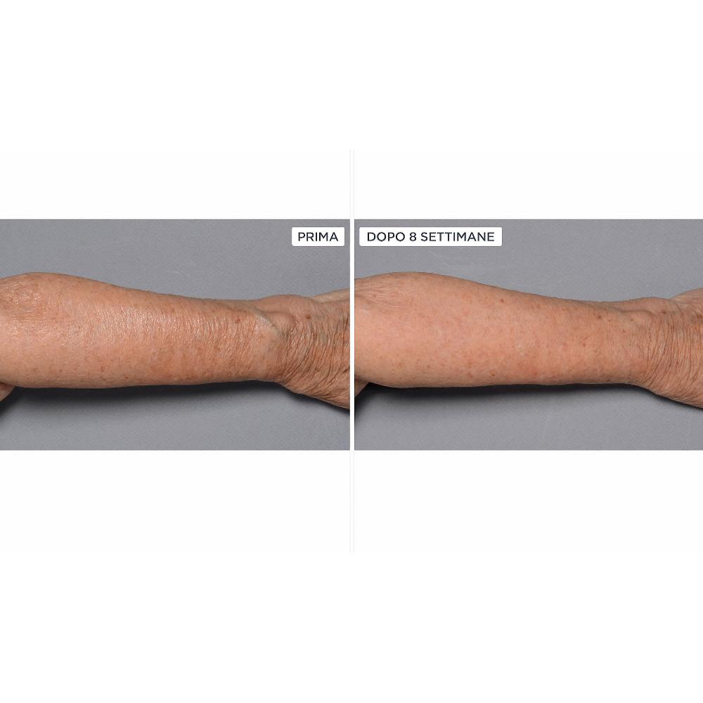 QVC Perricone MD Cold Plasma+Fragile Skin corpo 2pz Negozi Online