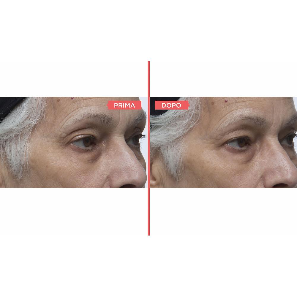 QVC Perricone MD Eyelid Serum Duo siero occhi antiossidante Grandi sconti