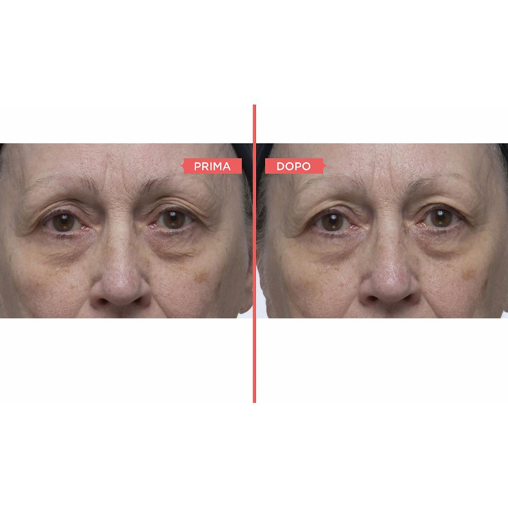 QVC Perricone MD Eyelid Serum Duo siero occhi antiossidante Grandi sconti
